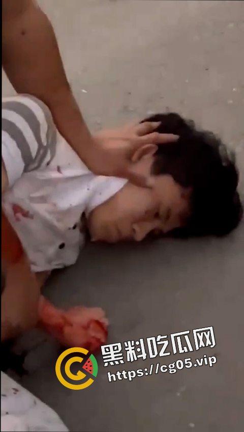 12.19日三亚南滨中学门口精神小伙为爱砍人!现场画面曝光 遍地鲜血 三名女子被砍伤 一人正在抢救中-4
