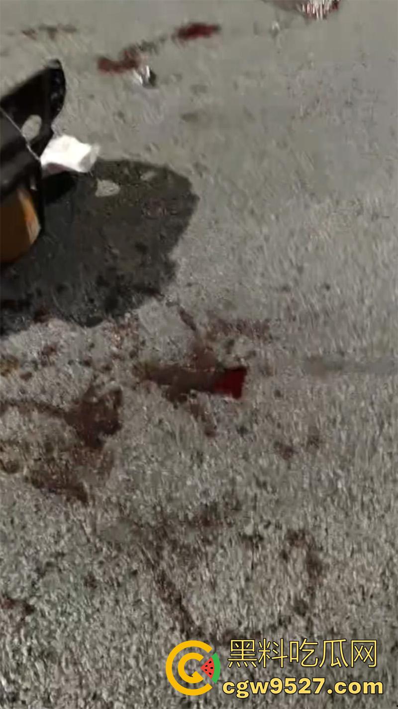 广西柳州鬼火少年,装逼失败翻车现场,自断一臂当场蒙逼,幸亏还留条命,估计再也不敢了吧!-5