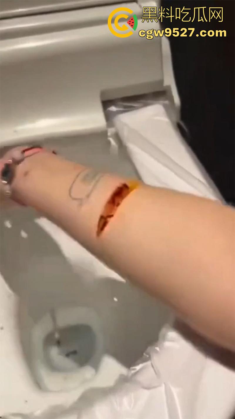 全网疯传马桶割腕女孩，真实自杀鸡皮疙瘩都起来了，脂肪层都割开了，还扒拉了一下，太重口了！-4