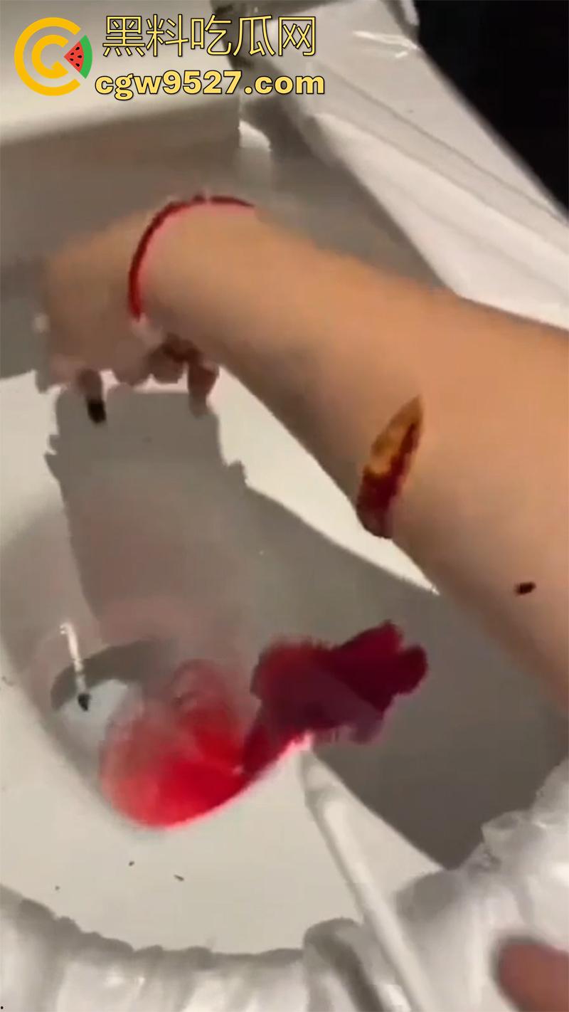 全网疯传马桶割腕女孩，真实自杀鸡皮疙瘩都起来了，脂肪层都割开了，还扒拉了一下，太重口了！-5
