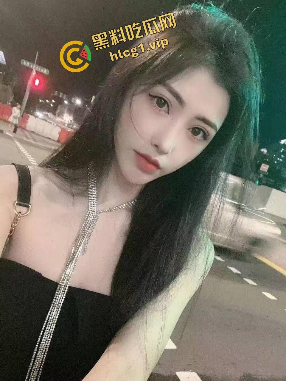 每个人体质不一样!瘦脸医美针害死人!肉毒整容 那女的 变 那女神!-11