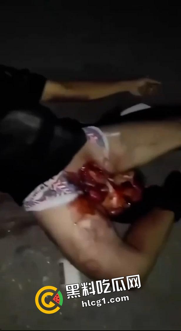 留学生圈又炸了！61当天加利福尼亚留学生男女车祸被腰斩 父母不愿收尸 现场血腥视频流出 这也太惨了-7