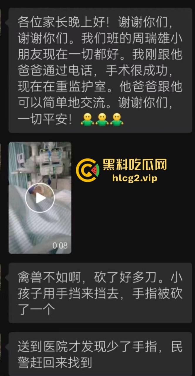 两口子吵架不比谁嗓门大 竟然砍下儿子手指 这操作竟然是亲妈?-1