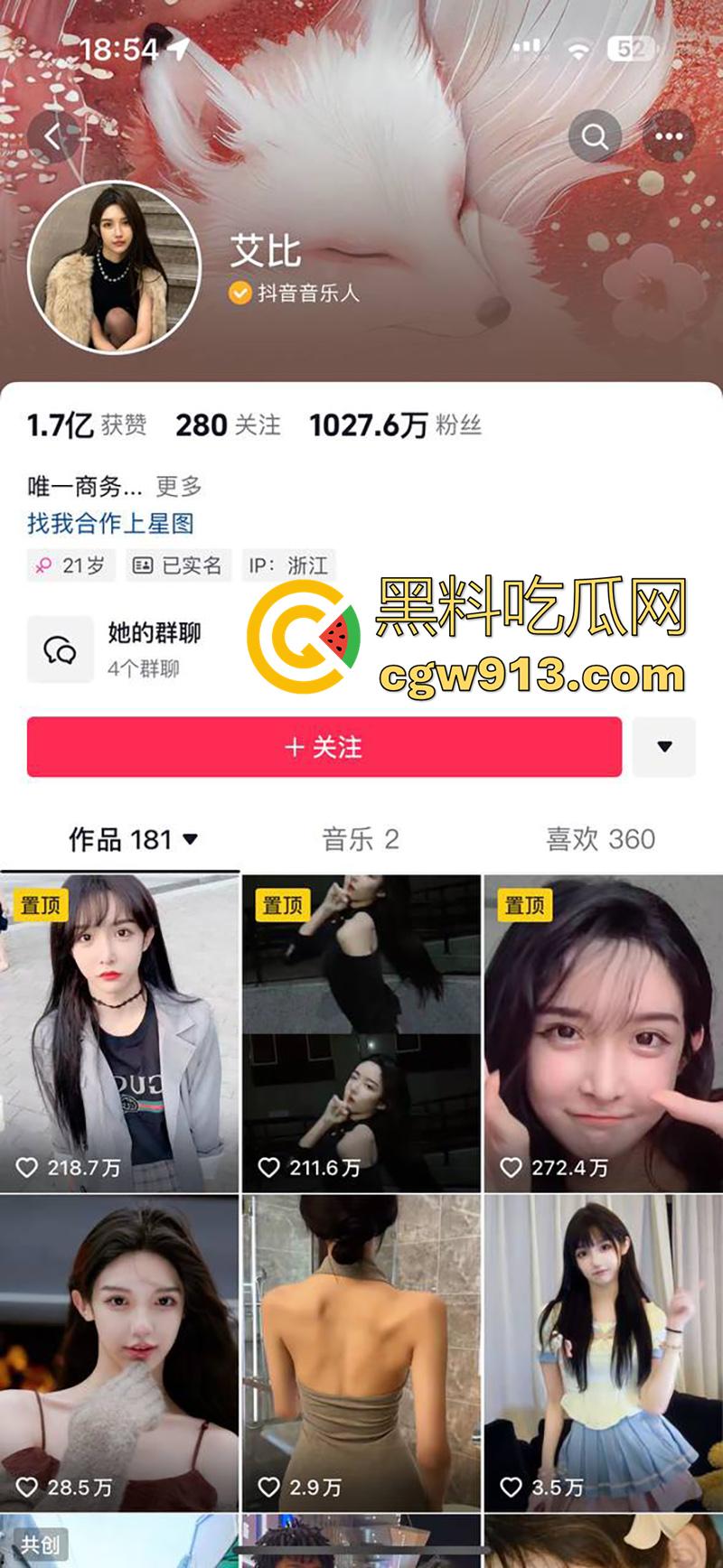 千万粉丝网红【艾比】,全网知名变性人,被爆出变性手术的前后对比,这小穴做的好逼真啊!-1