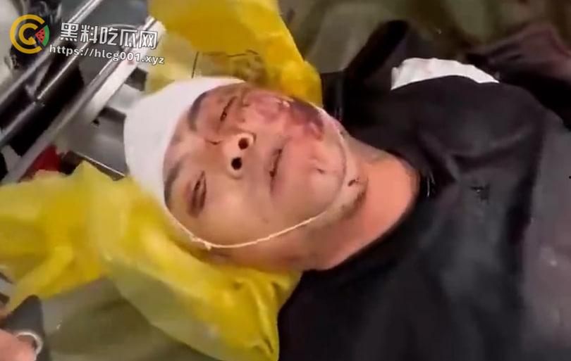 精神小伙战斗合集来了 国产小年轻群殴堪比古惑仔 现在的年轻人动起手真是不知道轻重-7